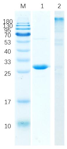 15% SDS-PAGE analysis profiles of purified StcrV2, His-tagged (CBB stained).